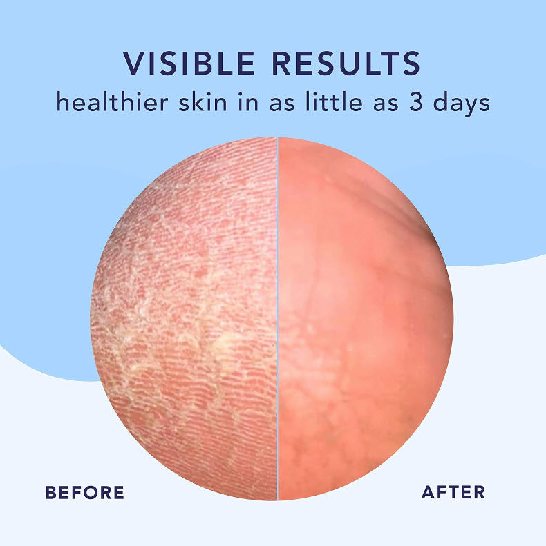 High Dive™ Intensive Hydration Cream